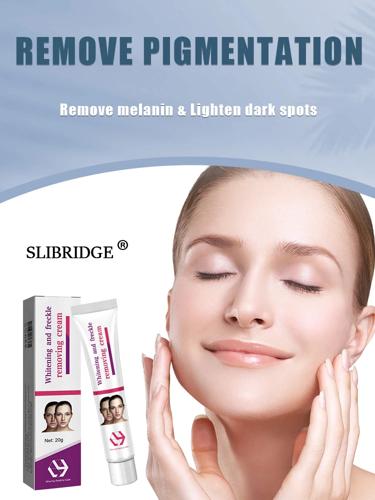 

freckle cream for melasma on the face
