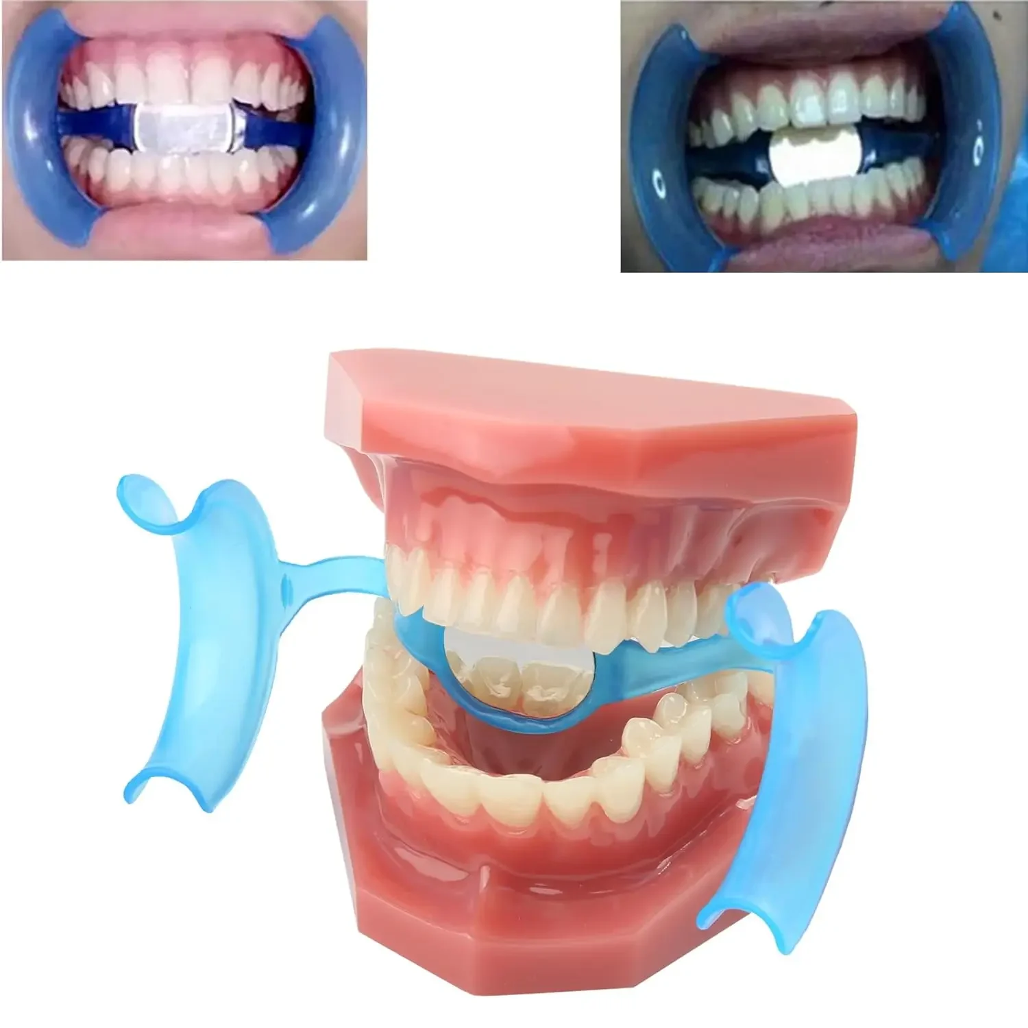 فتاحة فم ضام الخد للأسنان على شكل حرف M قابلة للتعقيم مع مرآة لتبييض الأسنان أدوات طبيب الأسنان (10 قطع أزرق)