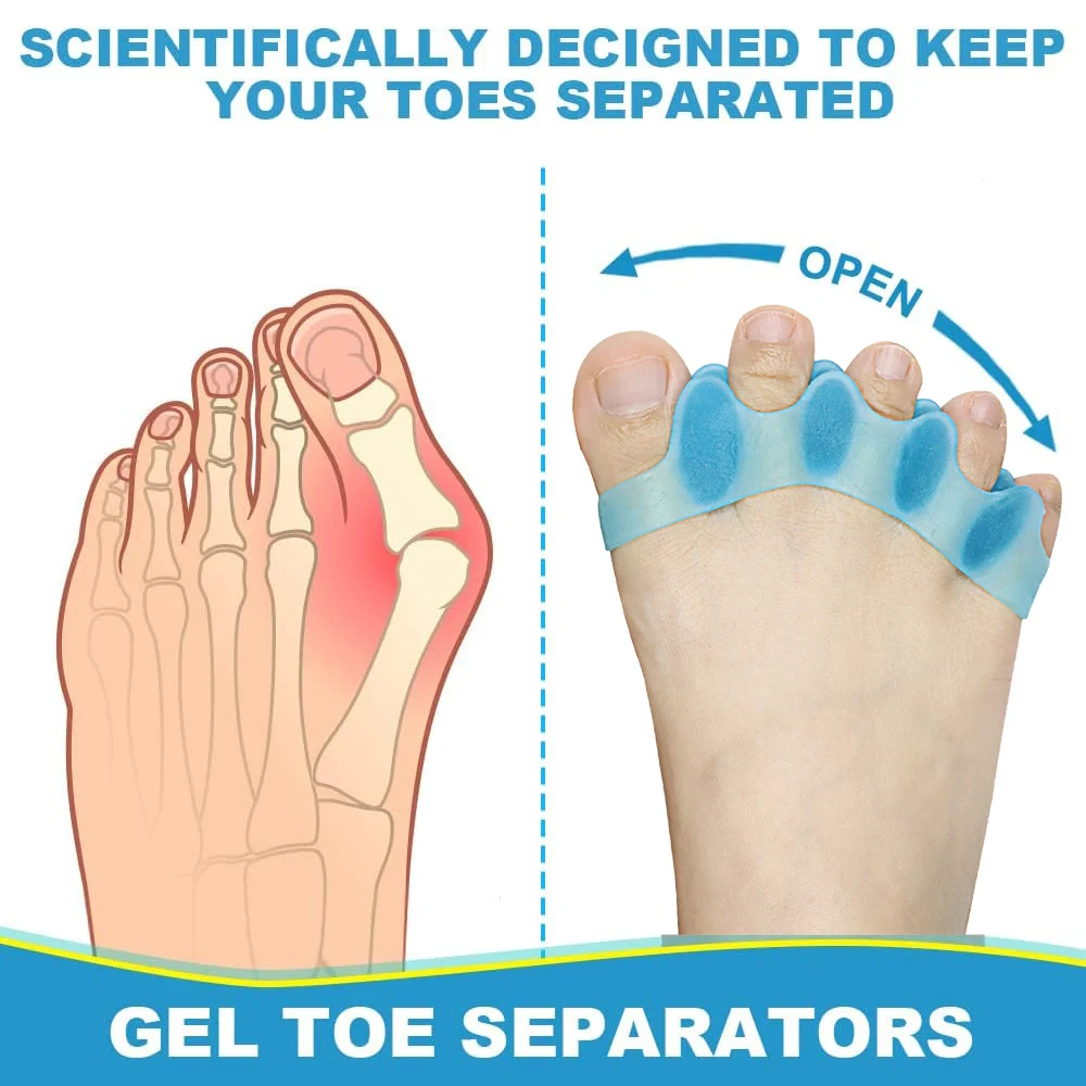Pexmen 2/4 pezzi separatori per dita in gel ripristinano le dita dei piedi alla forma originale correttore distanziatori per occhielli sovrapposti e vesciche