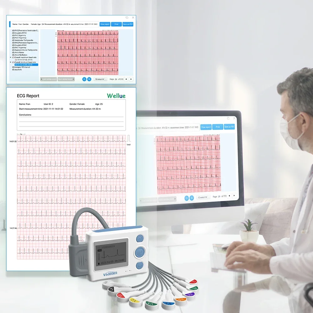 Viatom Th12  Medical 12 Channel 24 Hour monito System Holter Portable  Device monitoing Portable Machine Leads Ekg