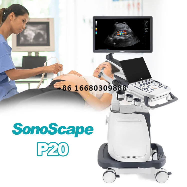 Sonoscape medical full digital ultra sound therapy device sonoscaepe P20 ultrasound machine color doppler