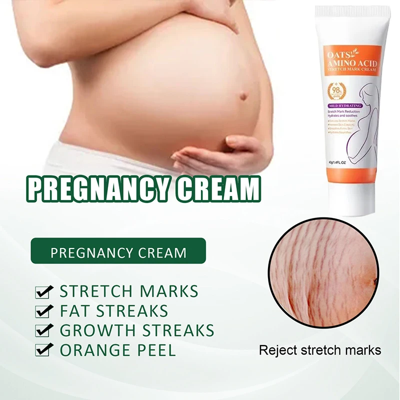 

Remove Skin Cracks Repair Firming Care Stretch Marks Moisturize Cream Eliminate Body Belly Stretch Marks Removal Swelling Marks