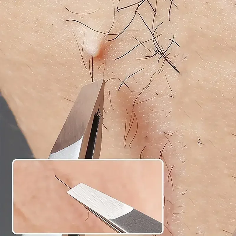 Set di pinzette per sopracciglia e viso in acciaio inossidabile per depilazione endogena: detriti di precisione e adatti sia per uomini che donne