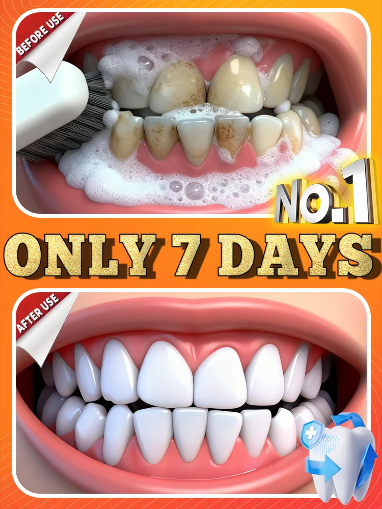 Nowa generacja, ulepszony środek do usuwania kamienia nazębnego rozpuszczający kamień i usuwający przebarwienia.