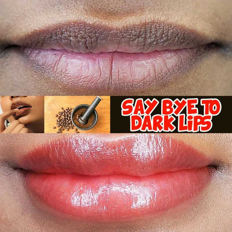 Remove Dark Smoke Lips Pink Fresh Lightening Bleaching Cream Treatment Lip Balm Whitening Moisturizer Nourishing Essence Lips