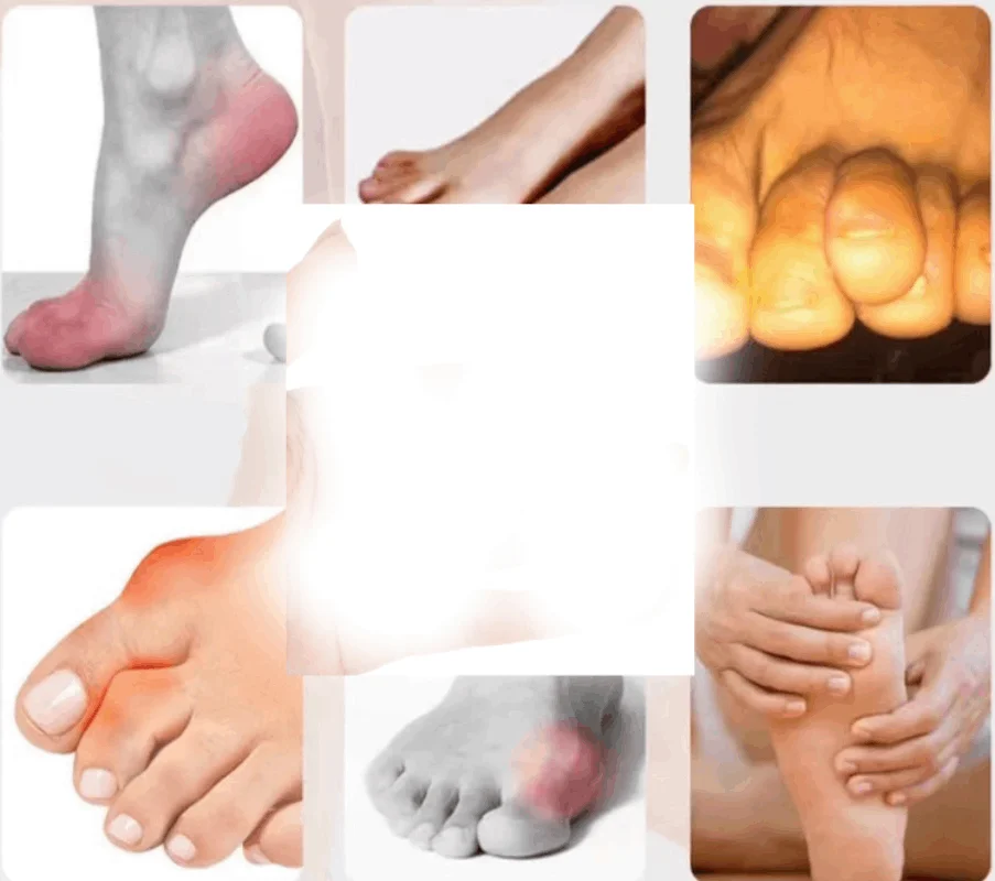 

1/2Pairs Green Hard Silicone Fingers Bunion Corrector Orthosis Toes Separators Stretcher Straightener Foot Care Protector