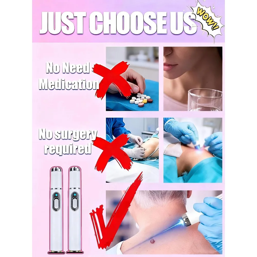 2025 Wart Removal Pen - Safe and Effective, Warts Fall Off Automatically