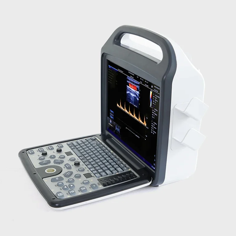 China Factory Supply Portable 3D Ultrasound Zhuyue Ultrasound Machine Color Doppler Price