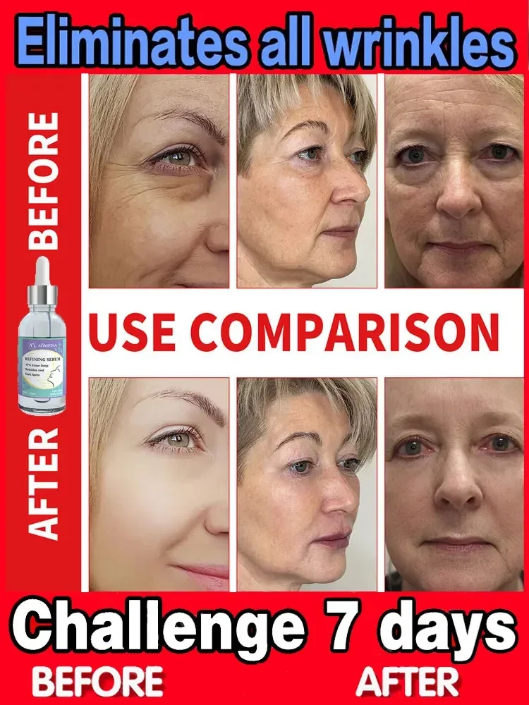 

Effective anti-ageing and anti-wrinkle facial serum to remove facial wrinkles fine lines around the eyes crow's feet neck wrinkl