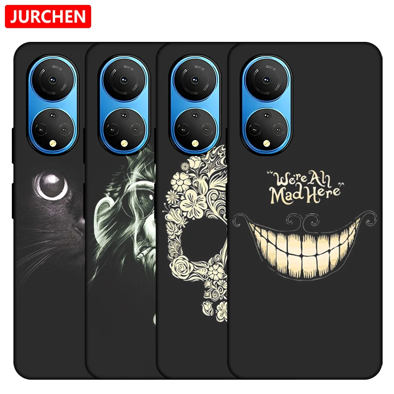 Silicone Cases For Huawei Honor X7 Cute Dog Cat Wolf Duck Lion Tiger Cartoon Pattern For Honor X 7 CMA-LX3 CMA-LX2 CMA-LX1 Cover image 4