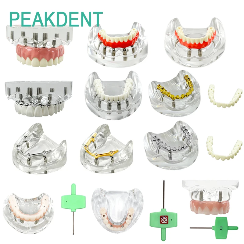 

Removable Upper/Lower Mandibular Covered Denture Models Dental Restoration Models 4/6 Implant Models Research Training Teaching