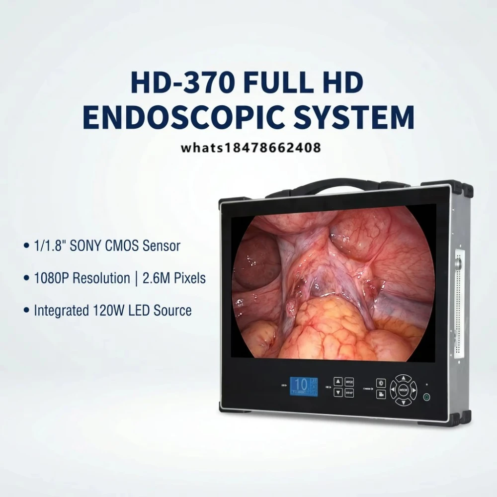 Huiyi Veterinary Endoscope 1080P high definition veterinary endoscope for animal clinics 120W LED USB