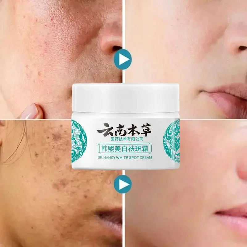 High-quality Niacinamide Melasma Brightening Cream Reduce Melanin Brighten Cream Lighten Dark Skin Chloasma Serum Fade Fine Line