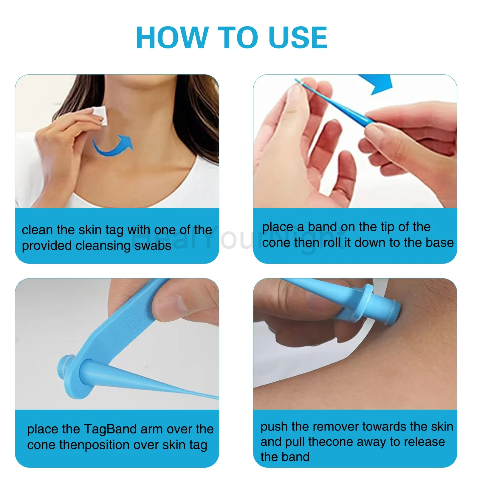 เครื่องมือดูแลความงามบนใบหน้า 3-IN-1 Auto Skin Tag Removal Kit ไม่เจ็บปวดผิวป้าย Mole สิวกําจัดหูดชุดปากกาทําความสะอาด Swabs