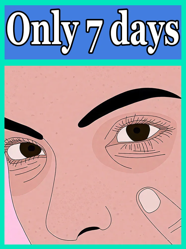 

Ceramide Repairing Eye Cream Strengthens Barrier Hot Selling in 2025