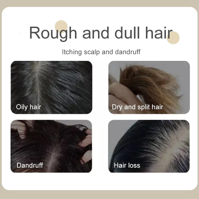 شامبو مضاد للقشرة شامبو من الأحماض الأمينية مضاد للقشرة ، جل استحمام منعش مضاد للحكة ، عطر يدوم طويلاً