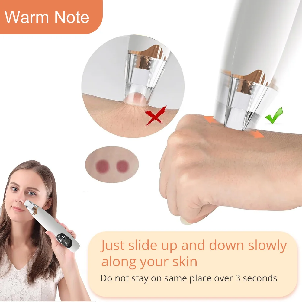 真空鼻にきびリムーバー洗顔美容機フェイシャル吸引クリーナーにきび角質リムーバー抽出スキンケア