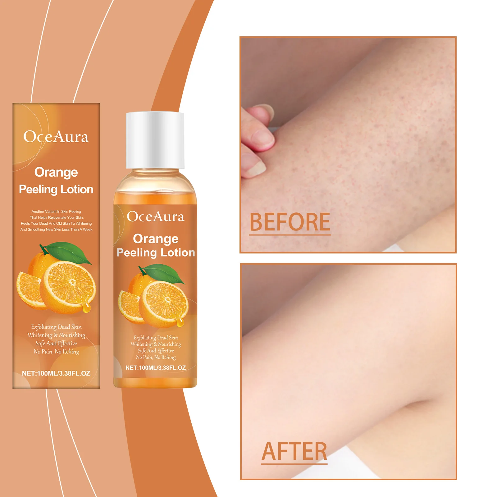 오렌지 껍질 각질 제거 에센셜 오일은 노화된 케라틴과 각질을 부드럽게 제거하고 피부를 매끈하게 해주고 에센셜 오일을 마사지해줍니다.