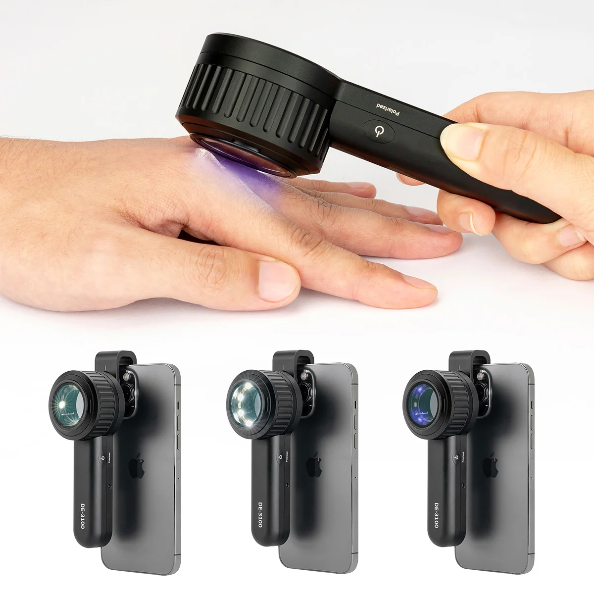 

IBOOLO DE-3100 PRO Dermatoscope 365nm UV Light Mode Fungal Skin Lesion Examination Polarized Light