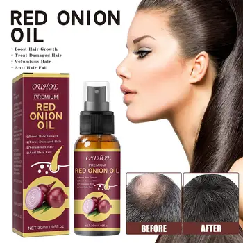 30ml สีแดงหัวหอมผลิตภัณฑ์ Black Seed Essential Oils สเปรย์น้ํามันสําหรับผมและ Growth ป้องกันผมร่วง H2U9