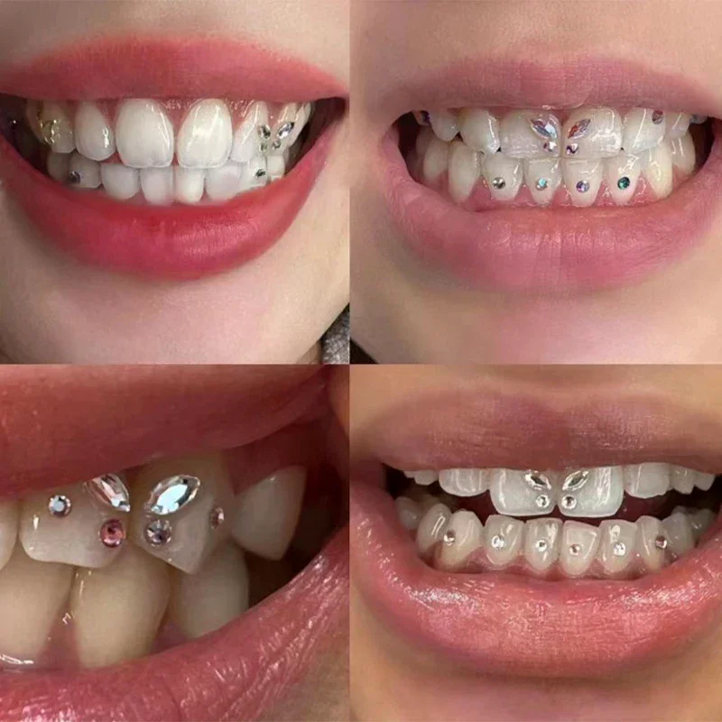 10Pcs Rhinestones For Dental Care Bur Dental Material Teeth Whitening Denture Acrylic Crystal Ornament Oral Hygiene Tooth
