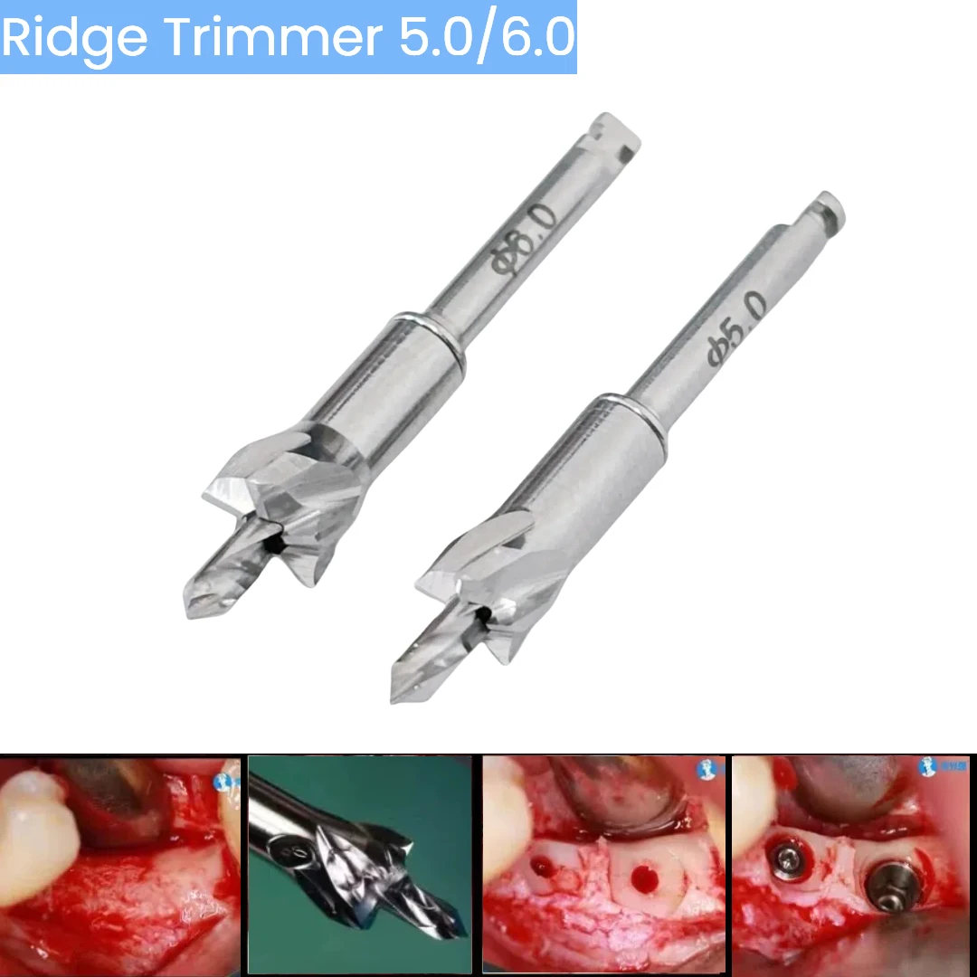 Dental Implant Bone Profiler Grinding Bur Surgical Instrument for OSS DEN ITI MIS Adin