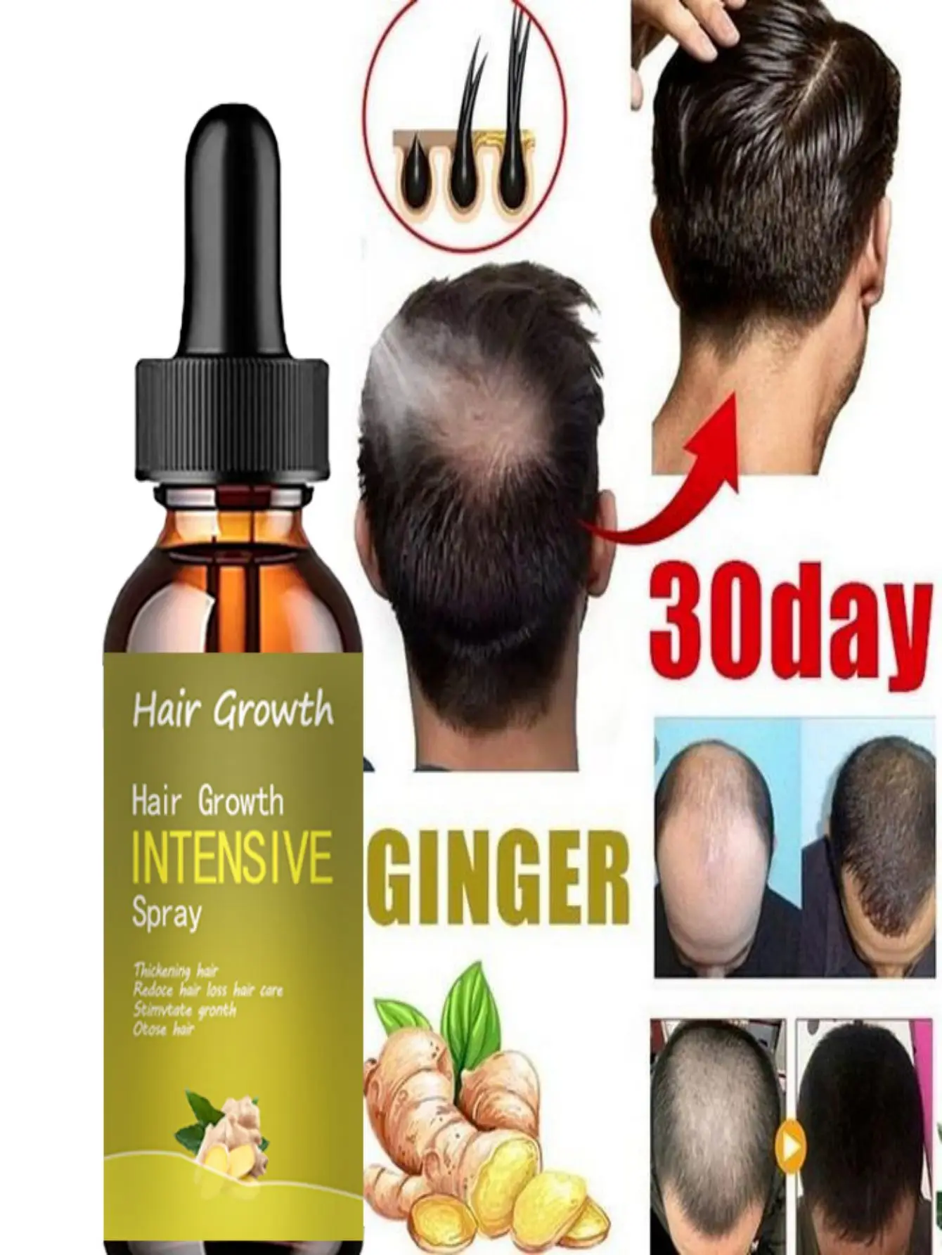 Ginger Hair Growth Essence Oils Products Anti Hair Loss Treatement Fast Growing Germinal Serum Prevent Scalp Damaged Men Women