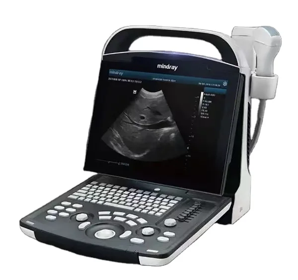 Mindray DP 10 Portable Ultrasound machine price