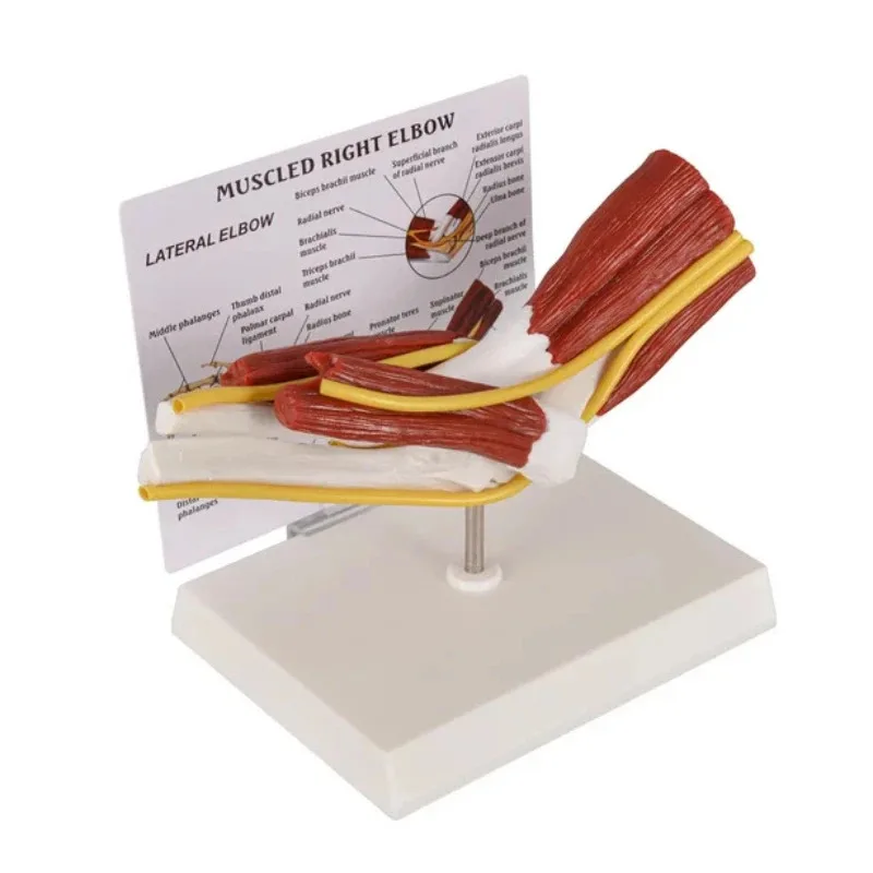 Human Elbow Joint Anatomy Model (Including Muscles, Bones, And Nerves), Life Size Medical Teaching Demonstration Teaching Tool