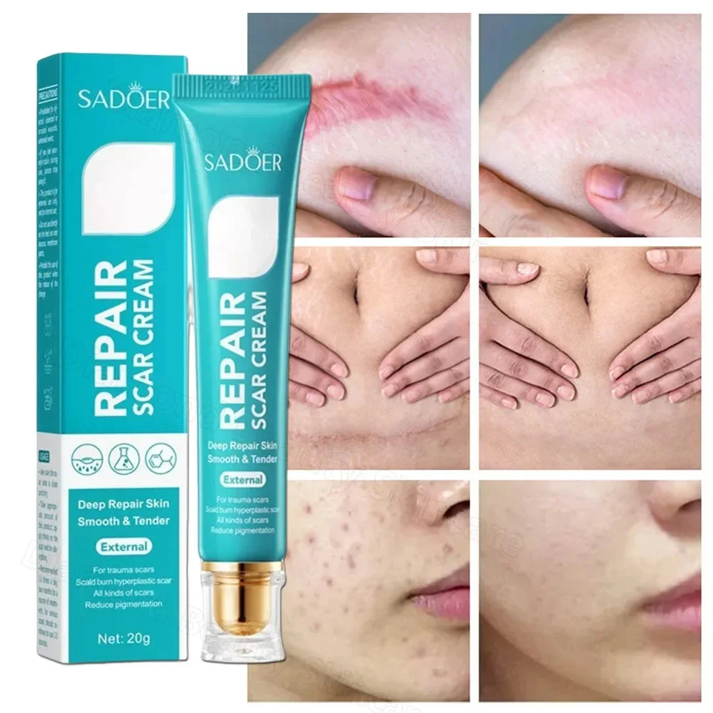 Fast Scar Removal Cream Effective Treatment Stretch Marks Burn Surgical Scars Acne Spot Repair Whiten Moisturizing Skin Care