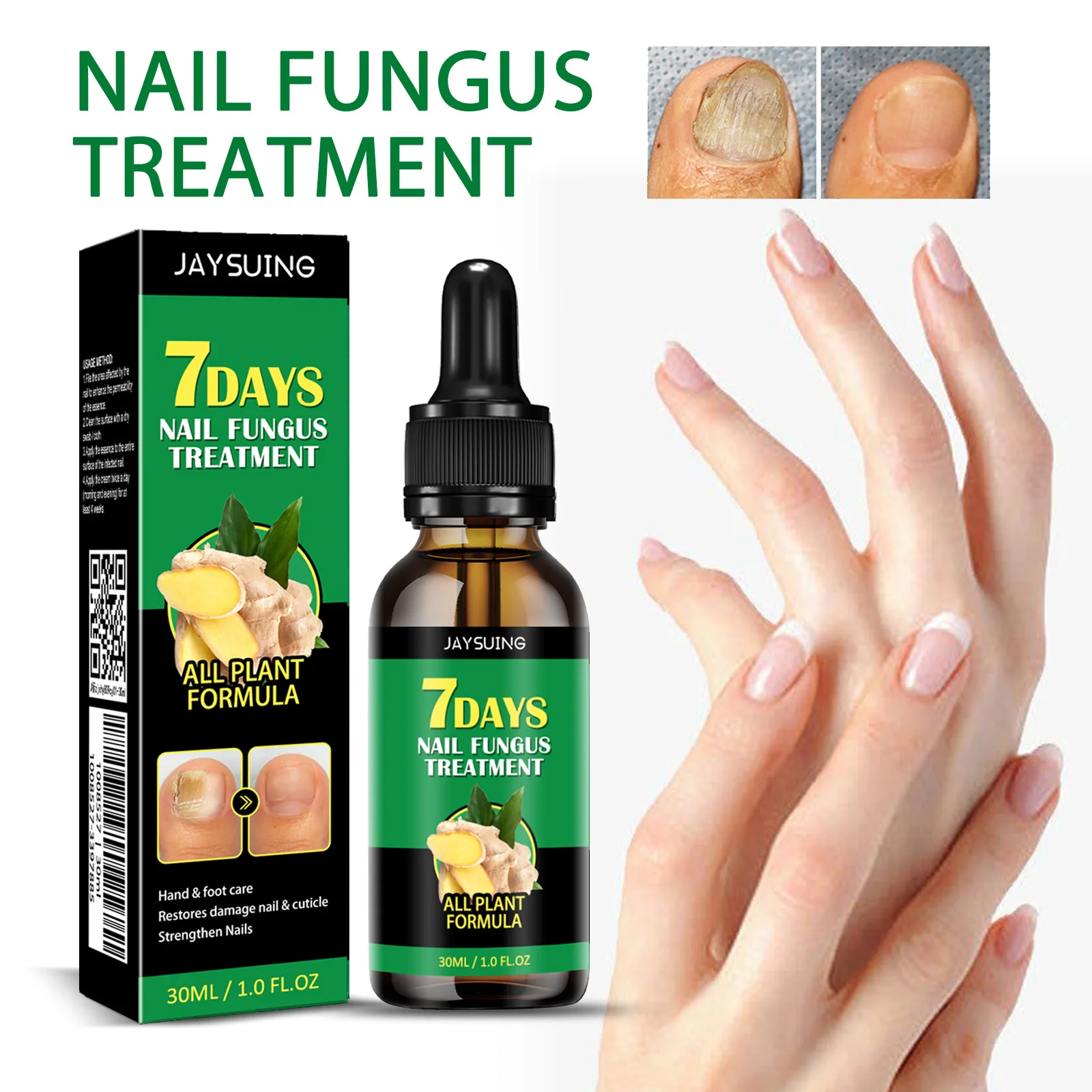 Toenail Care Solution Natural Nail Essence Fix Renew Damaged Molds Nail Broken Cracked Discolored Nails Fast Repair Serum