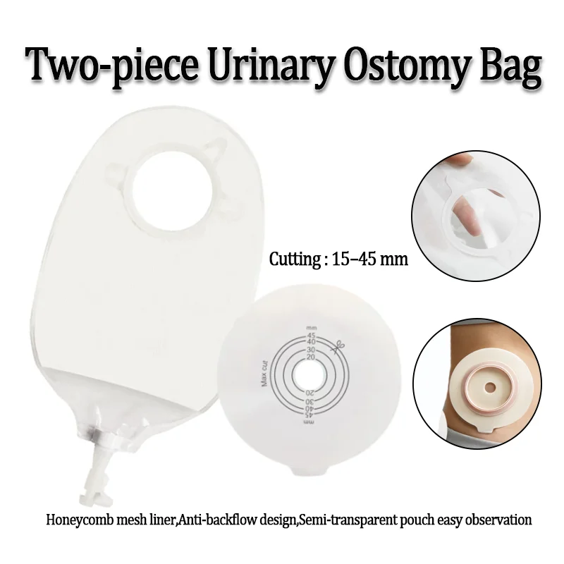 Two-Piece Urinary Ostomy Bag Hydrocolloid Baseplate Anti-Backflow Design Urostomy Pouch Stoma Care Supplies