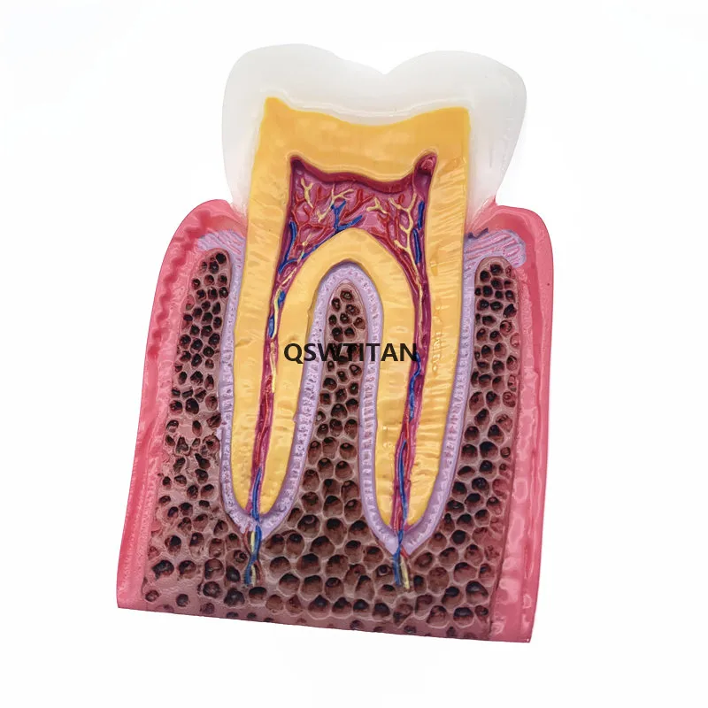 Dental Caries Teeth Comparation Model Dental Study Education Demonstration Teaching Model