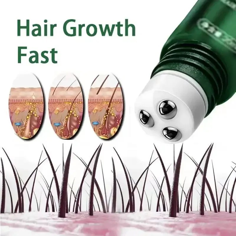 

Hair Growth Oil Fast Hair Growth Essence Effective Baldness Repair Hereditary Postpartum Hair Loss Seborrheic Hair Loss products