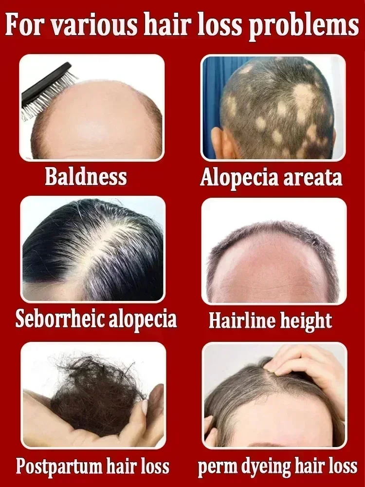 Prevent shedding, reduce hair loss, hair growth,