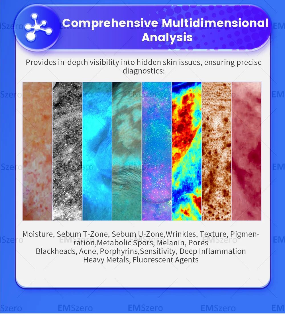 MYOSLIM Body fitnes الكهربائية التخسيس 6500 واط عالية الطاقة 4 مقابض تقليل الدهون آلة صالون تجميل جديد EMS صفر فقدان الوزن