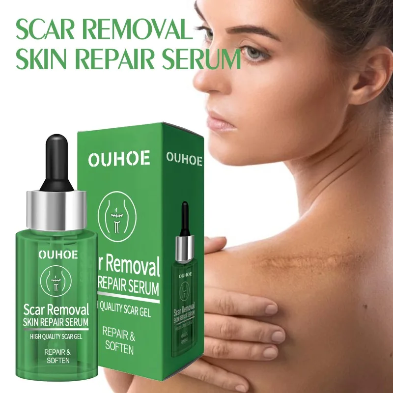 Scar Removing Skin Repair Serum Natural Face Creams Moisturizer Smooth Skin Treatment Lightening Scar Repair Gel Body Skin Care