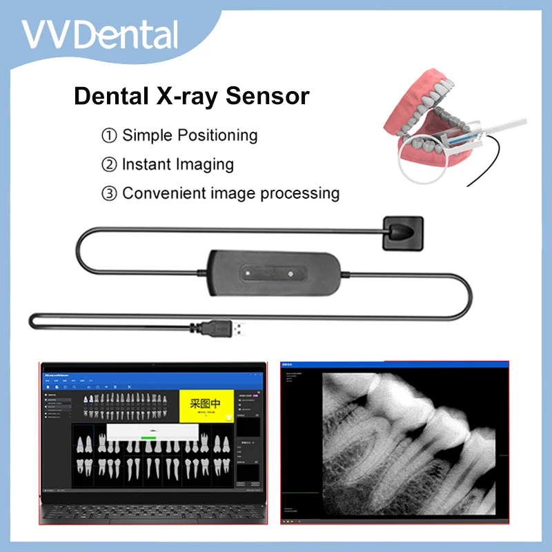 

Dental RVG Sensor X-Ray Radiovisiograph Digital Sensor Intraoral Imaging System HD Image Camera Oral Medical Dentistry Tools