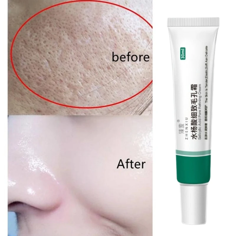 Crema facial para reducir los poros, suero reparador de ácido salicílico para reafirmar los poros grandes, eliminar los puntos negros, piel rugosa y