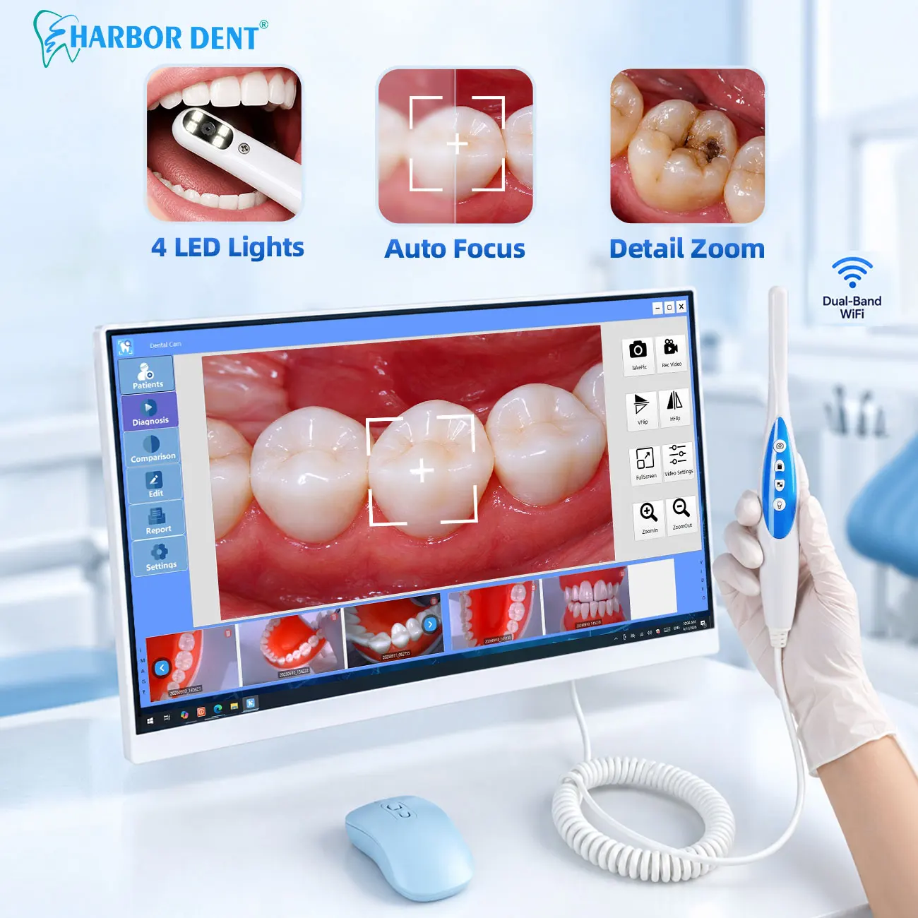 24-Inch Dental Intraoral Endoscope Scanner Camera HDTouch Screen LCD Monitor WIFI  All-in-One Built-in Win10 Computer System