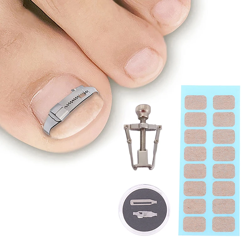 1Set Professional Ingrown Toenail Corrector Tools Pedicure Recover Embed Toe Nail Treatment Foot Care Correction Tool Care Foot