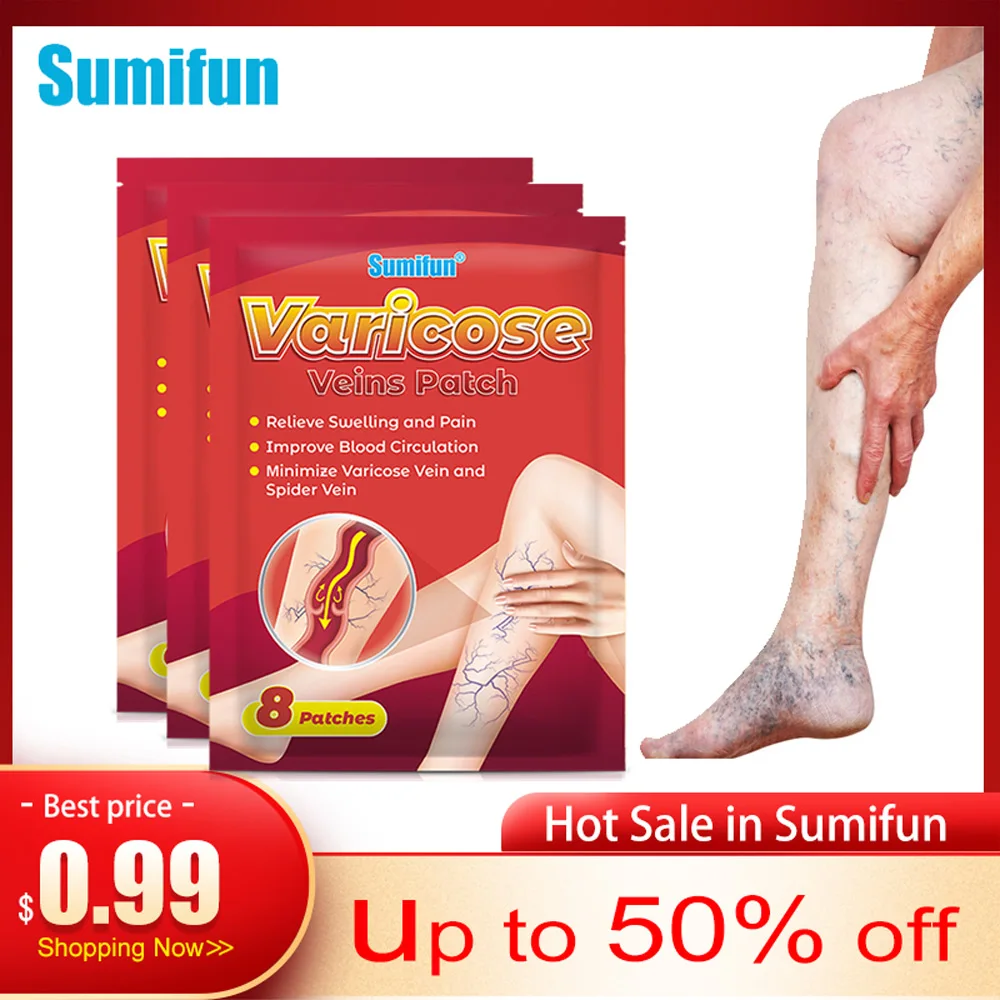 

8/24/56/80pcs Varicose Veins Patch Effective Cure Leg Acid Vasculitis Phlebitis Spider Vein Pain Relief Sticker Angiitis Plaster