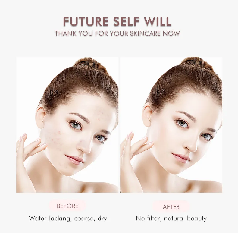 Espátula ultrasónica para la piel de grado profesional: herramienta limpiadora de poros y dispositivo eliminador de espinillas, instrumento de belleza facial para uso doméstico