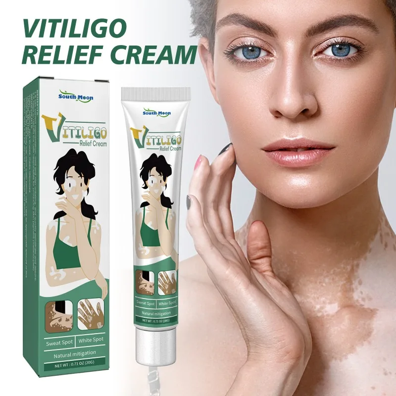 Ungüento de Vitiligo para eliminar eficazmente el Vitiligo, pomada de reparación Natural, elimina la tirita, manchas blancas, elimina el Vitiligo de la piel, cuidado de la piel, 20g