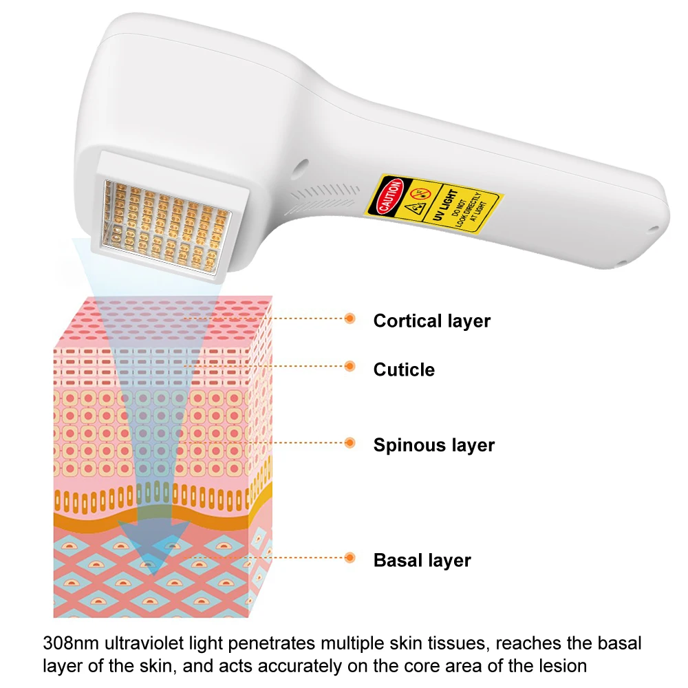 ZJZK Ultraviolet Light To Treat Psoriasis Blue Light Therapy After Botox 308nmx64diodes UV Light For Psoriasis At Home Eczema