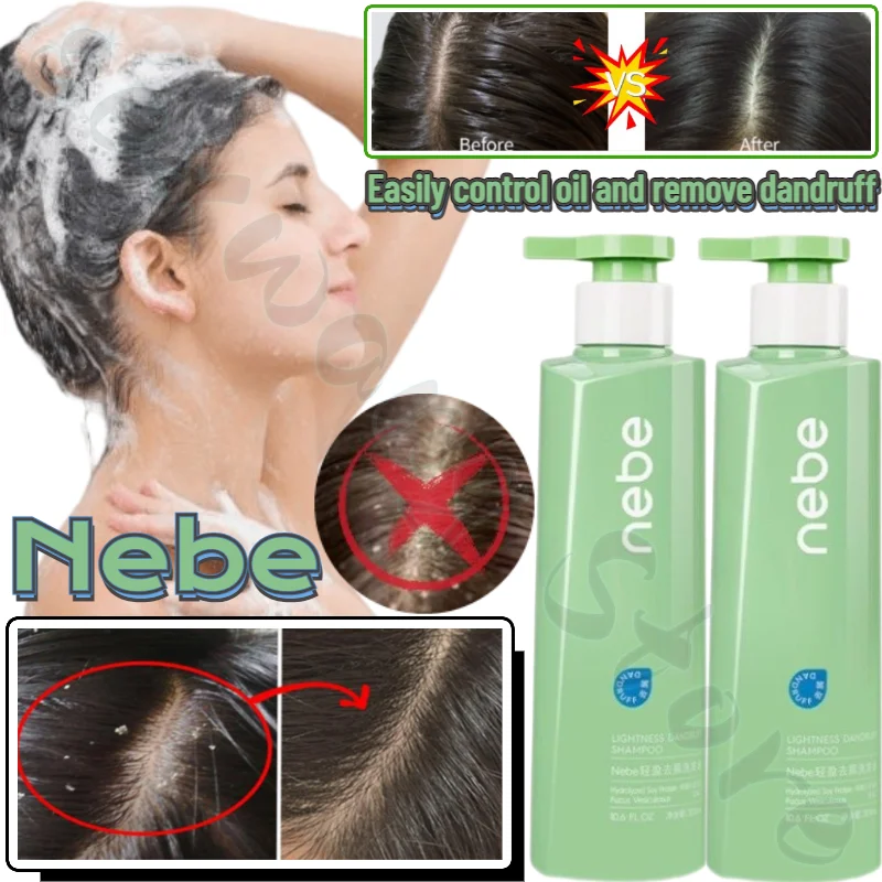 

Шампунь от перхоти и перхоти Nebe очищает кожу головы, снимает жирность, пушистый, гладкий и ароматный шампунь 300 мл