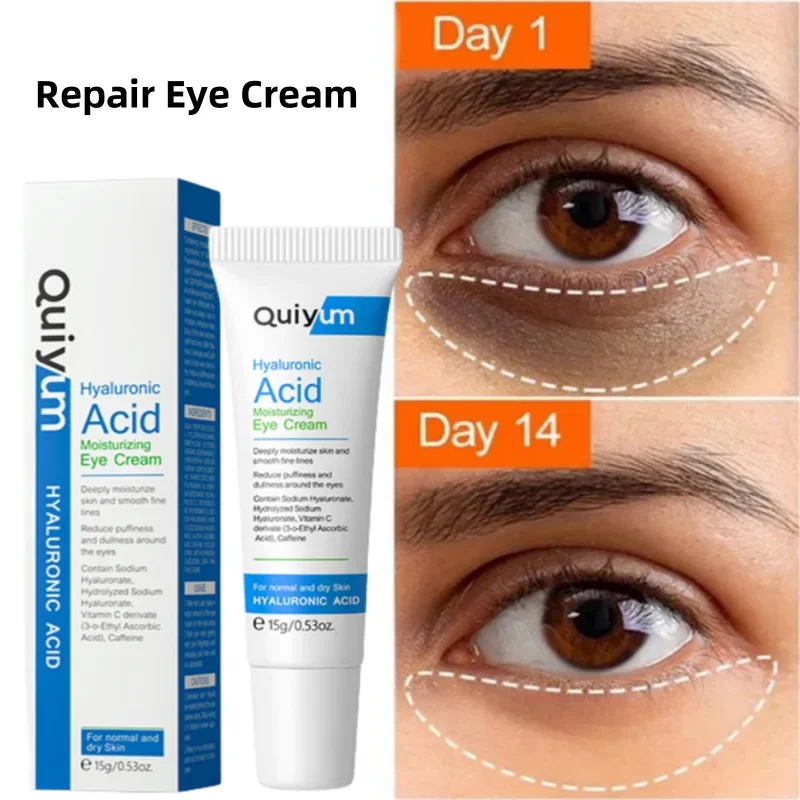 

Eye Dark Circles Remover Cream Retinol Anti-aging Serum Remove Eye Bags Puffiness Fade Wrinkles Fine Lines Lift Firm Eye Care