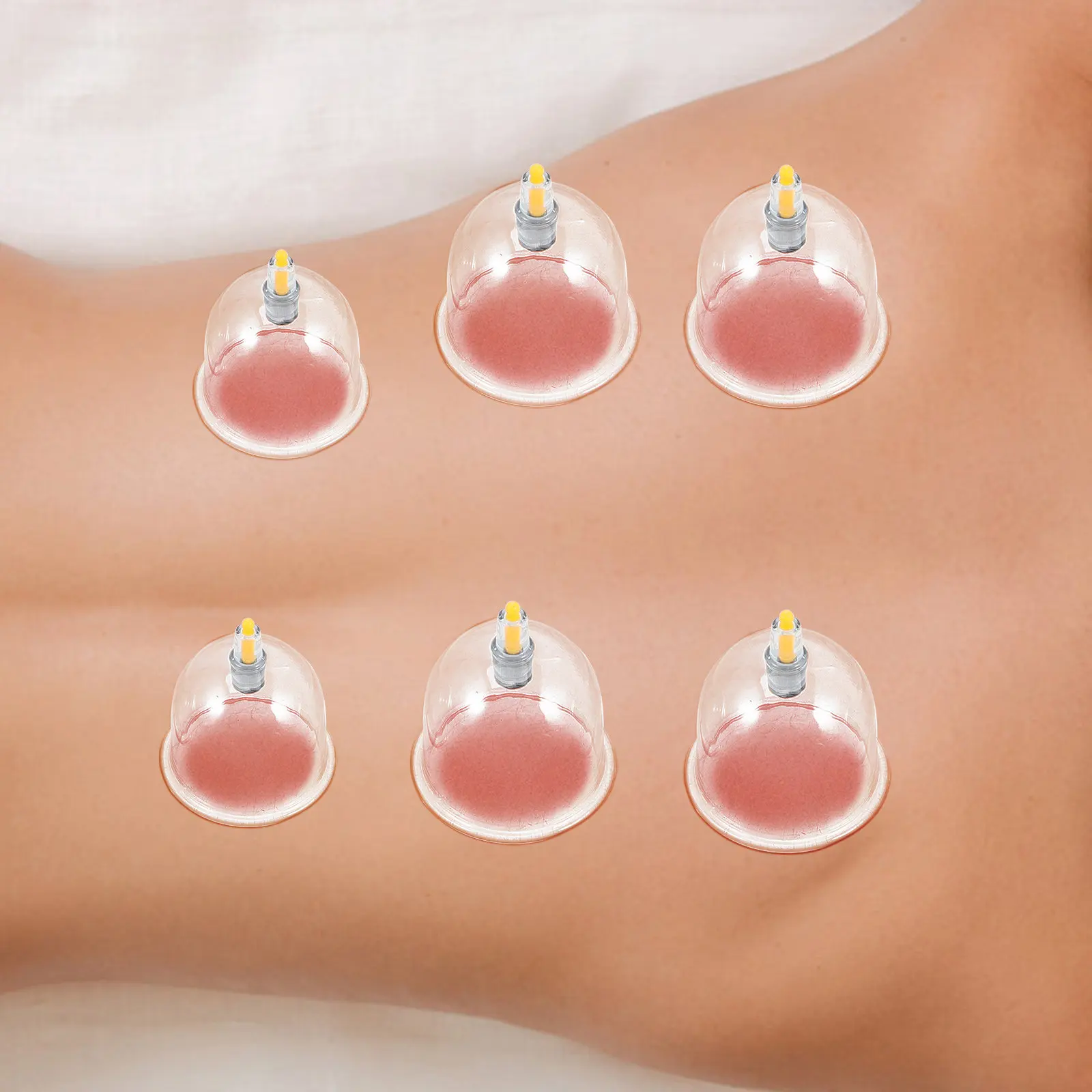 

1Set Vacuum Cupping Device Premium Plastic Therapy Kit Household Chinese Cupping Cups Body Care Set Promote Circulation
