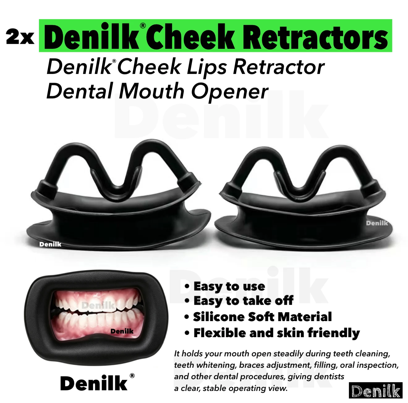 DENILK 2pcs Pair of Dental Orthodontic Silicone Mouth Opener Cheek Retracor Tooth Intraoral Lip Cheek Retractor Soft Consumables