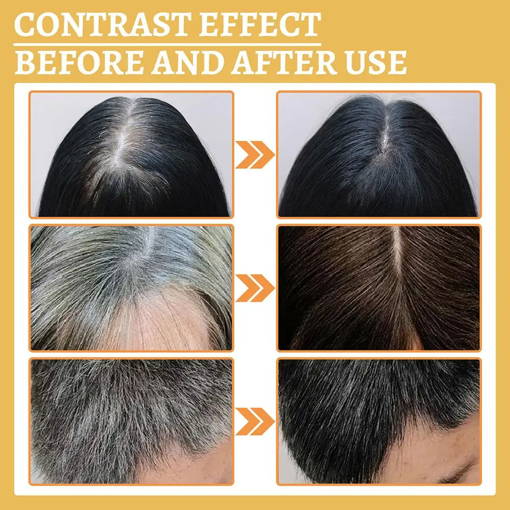 5pcs Gray White Hair Treatment Serum Liquid White To Black Natural Color Repair Nourish Product Anti Loss Hair Care Men Women